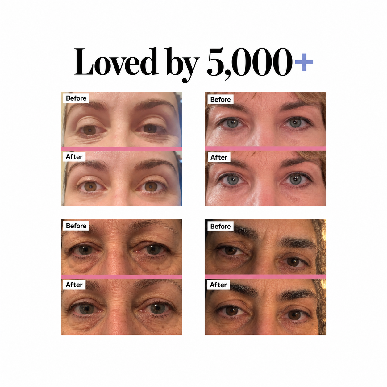 Lourio WakeLift Microcurrent Facial Device
