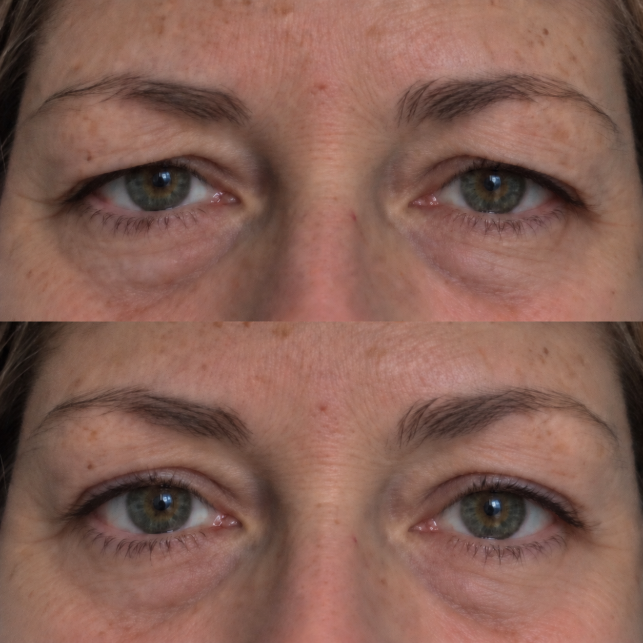 Lourio WakeLift Microcurrent Facial Device
